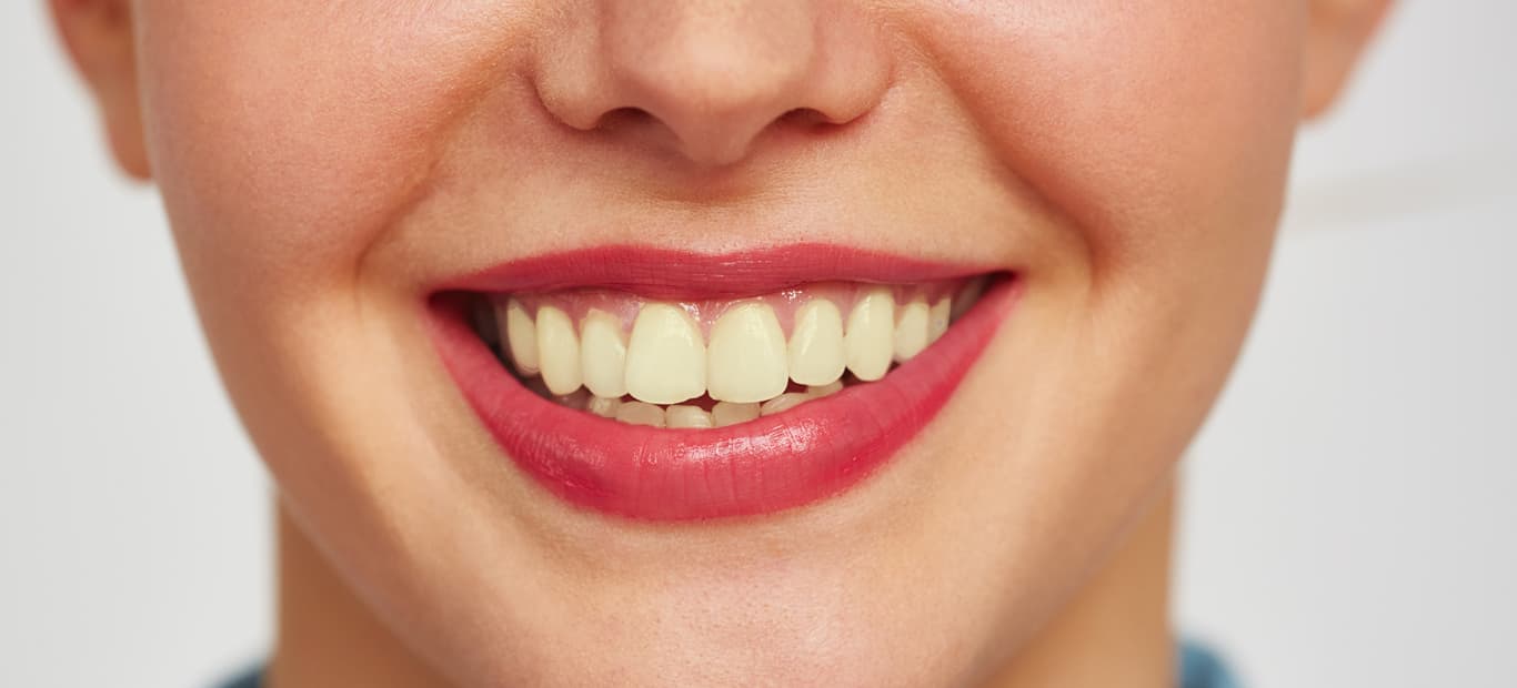 before and after smile